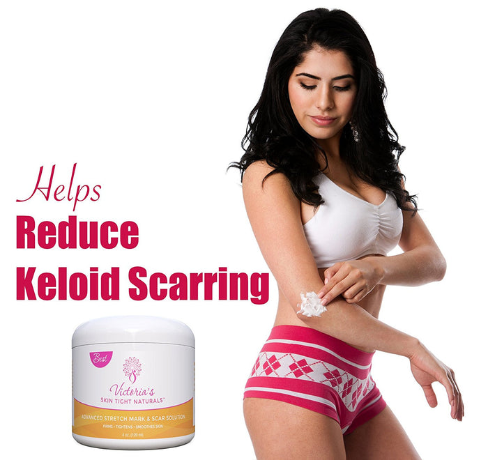 Best Stretch Marks Removal Cream, Prevent & Reduce Marks