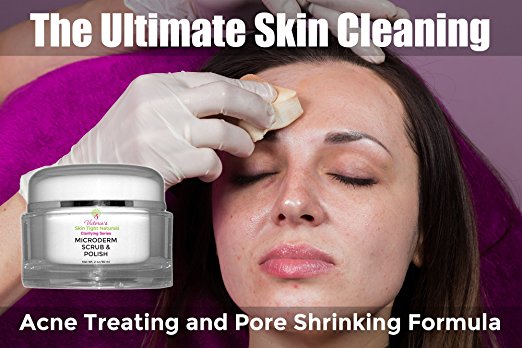 Microdermabrasion Exfoliation Skin Polish Cream For Crepe Skin