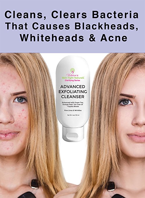 women's Hormonal Acne Exfoliating Cleanser For  Pimples Breakouts Wrinkles and Anti-Aging GLycolic Acid Kojic Acid cleanser