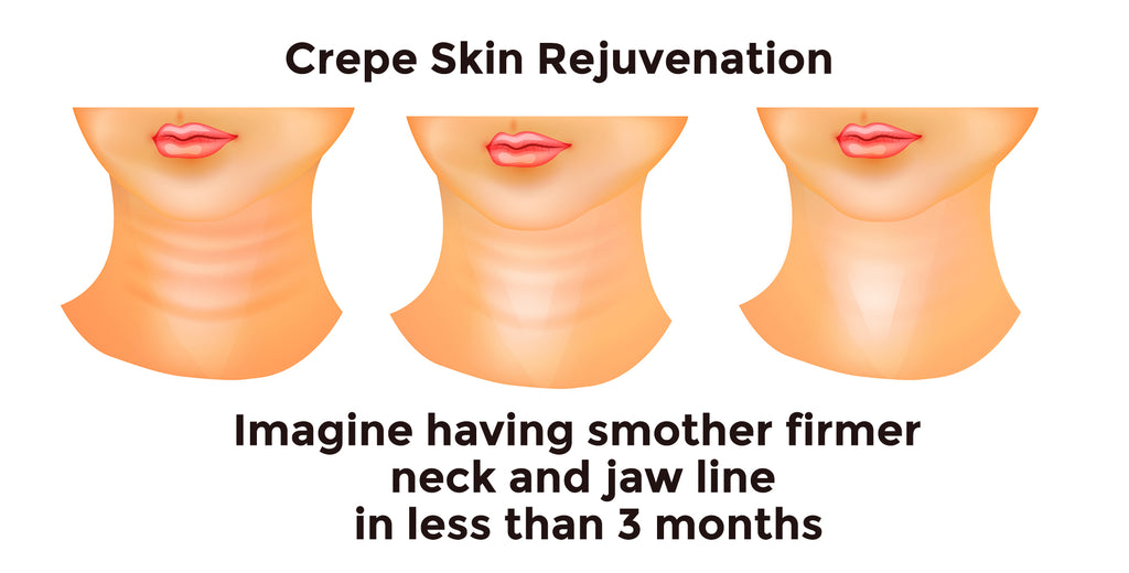 crrepe skin neck and jawline tightening 